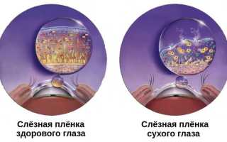 Симптомы заболевания синдром сухого глаза