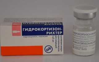 Лечение туннельного синдрома запястья мазями