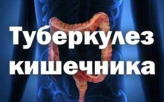 Синдром коха что это такое