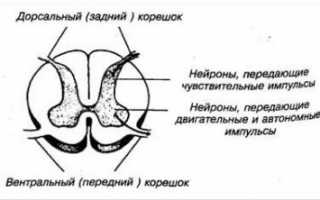 Корешковый синдром поясничный остеохондроз лечение