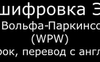 Экг синдром впв тип б у