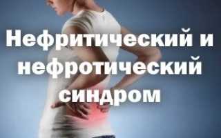 Нефритический и нефротический синдром отличия таблица
