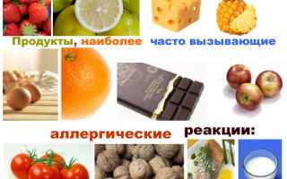 Пищевая аллергия код по мкб 10 у детей
