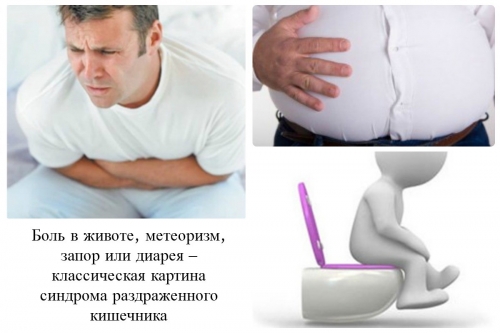 Обложенный язык при синдроме раздраженного кишечника