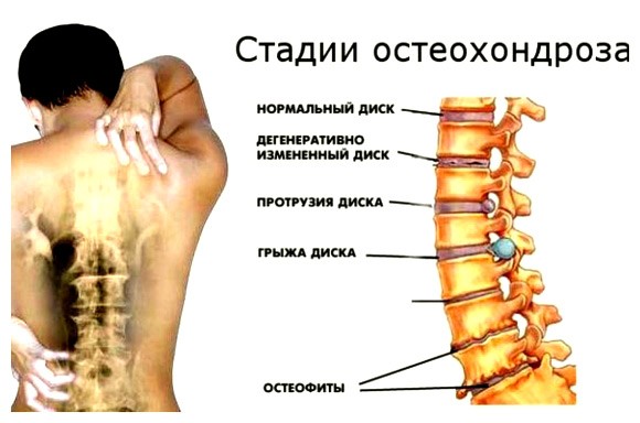Боли в грудине код по мкб