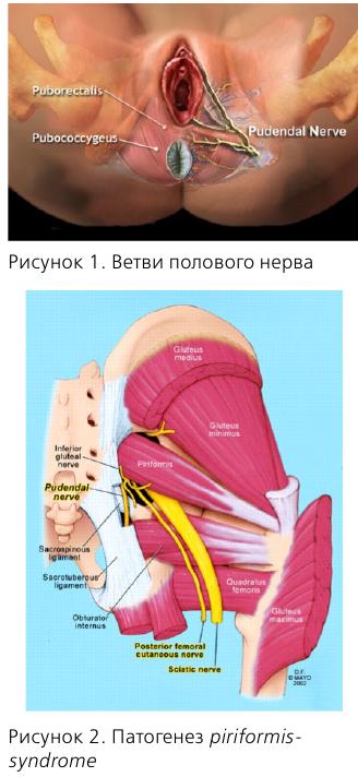Лечение миофасциального синдрома в сочи