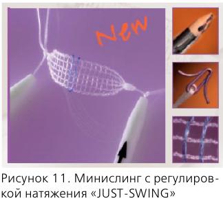 Лечение миофасциального синдрома в сочи