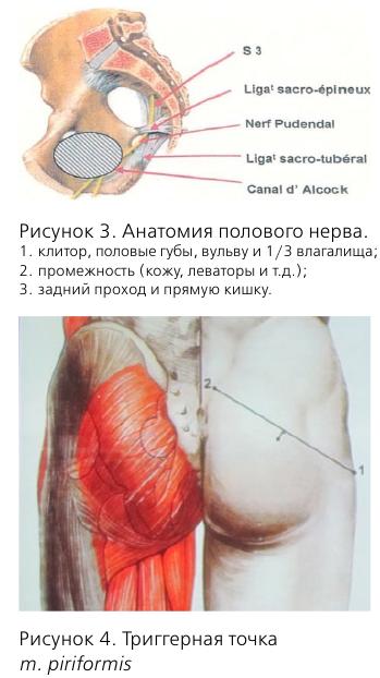 Лечение миофасциального синдрома в сочи