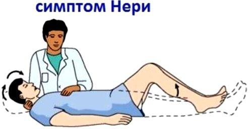 Остеохондроз пояснично крестцового отдела с радикулярным синдромом